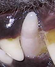Lila verfärbter Zahn 