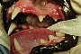 preview: Gingivitis oder auch Zahnfleisch­entzündung