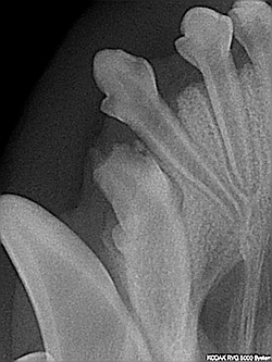 Fehlender Zahn - Röntgenbild