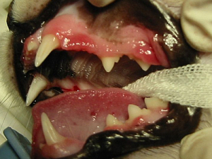 Gingivitis oder auch Zahnfleisch­entzündung