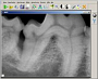 Digitales Dental-Röntgen - für kurze Narkose-Zeiten
